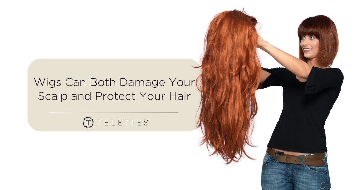 Wigs Can Damage Your Scalp and Protect Your Hair