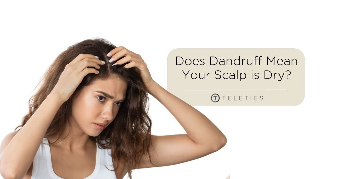 Does Dandruff Mean My Scalp Is Dry?